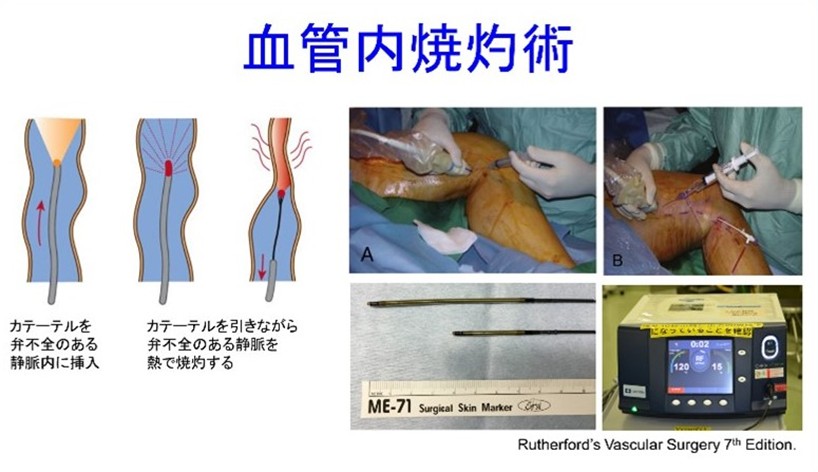 血管外科｜診療案内｜九州大学大学院 消化器・総合外科（第二外科）